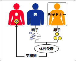 卵子提供プログラム