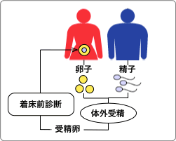 着床前診断プログラム