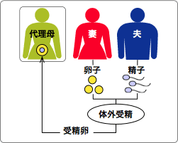 代理出産プログラム